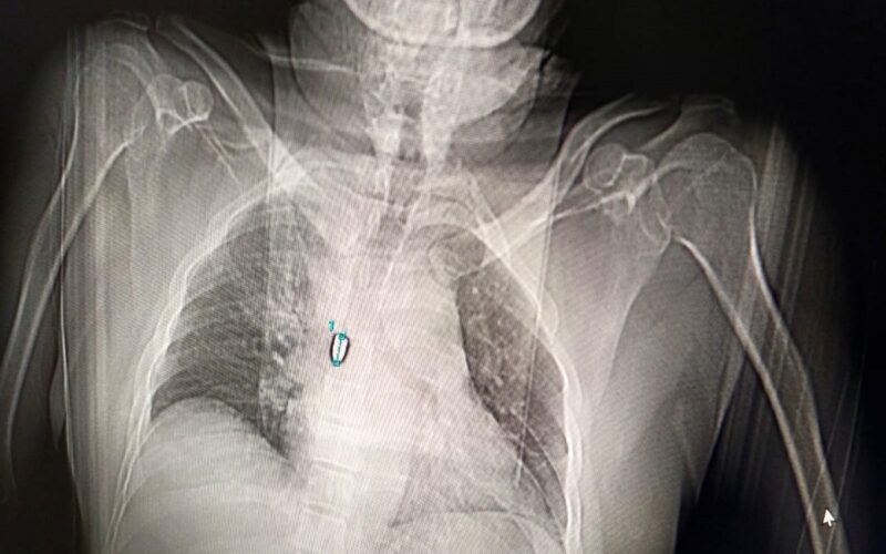 मालदामा फेरि गोलीबारी: चार जना अपराधीहरूले एक व्यापारीमाथि दुई गोली प्रहार गरे, अवस्था गम्भीर