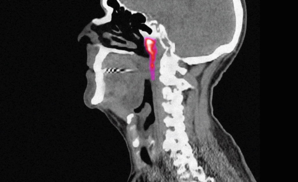 वैज्ञानिकहरूले पत्ता लगाए नयाँ थुक ग्रन्थी