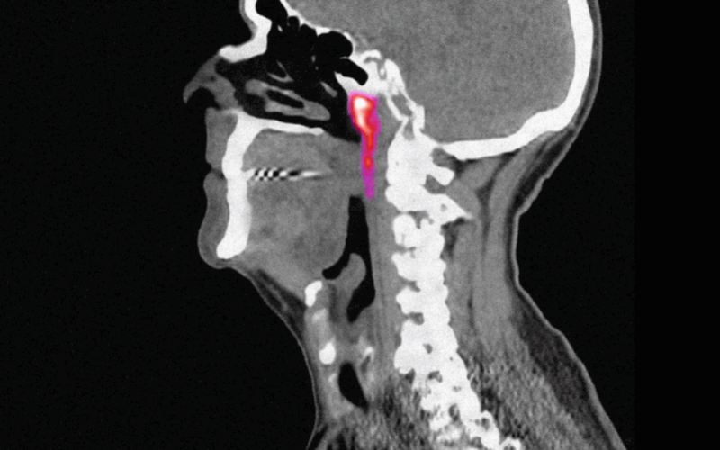 वैज्ञानिकहरूले पत्ता लगाए नयाँ थुक ग्रन्थी